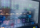 Patient Monitoring