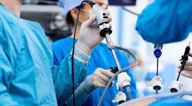 Laparoscopy