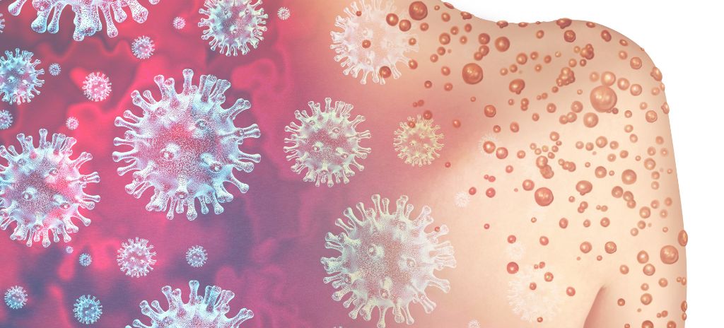 Monkeypox Test FDA EUA (Emergency Use Authorization) Assistance 