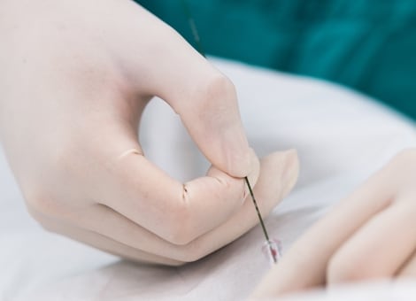 Interventional