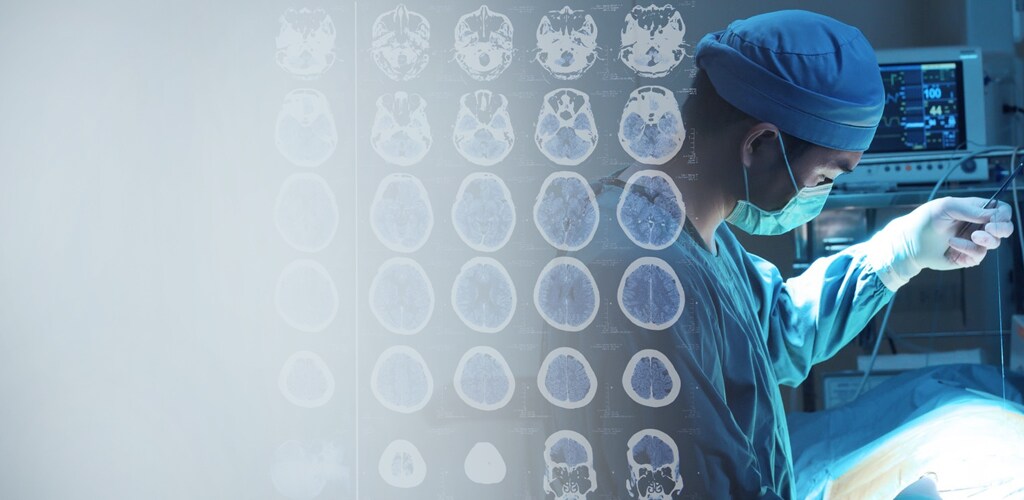 Tecnologias de intervenção neurovascular