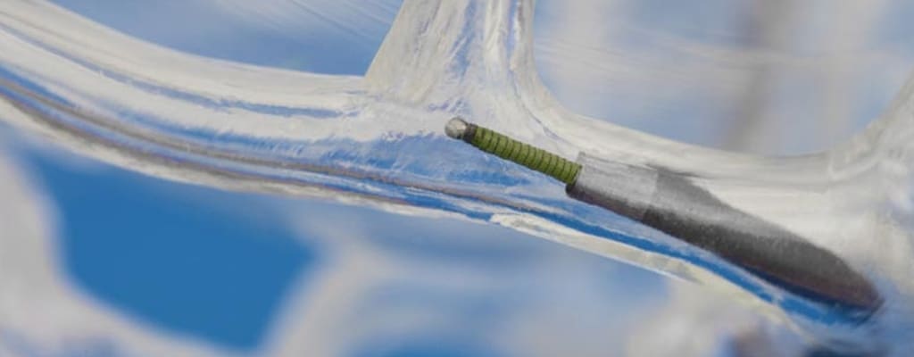 A fresh perspective in guidewire design