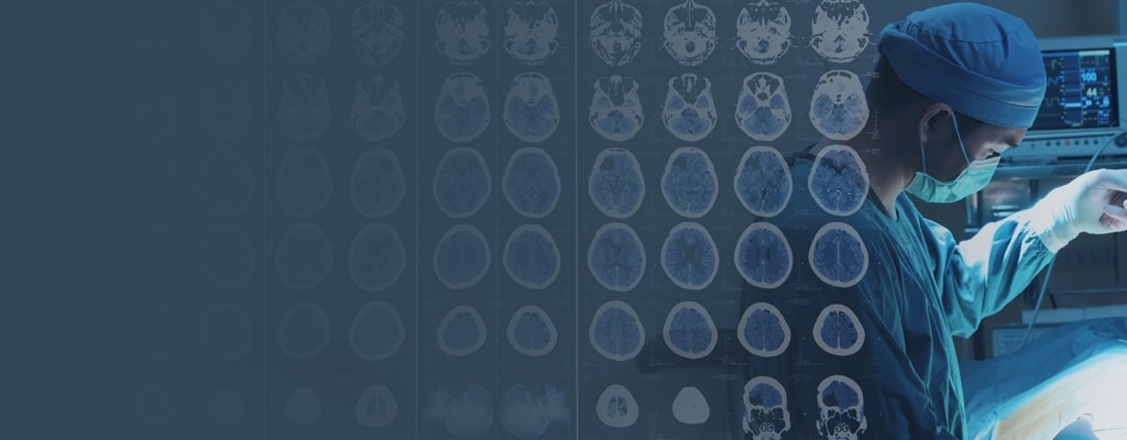 Experiencia en unión de materiales para neurodispositivos avanzados