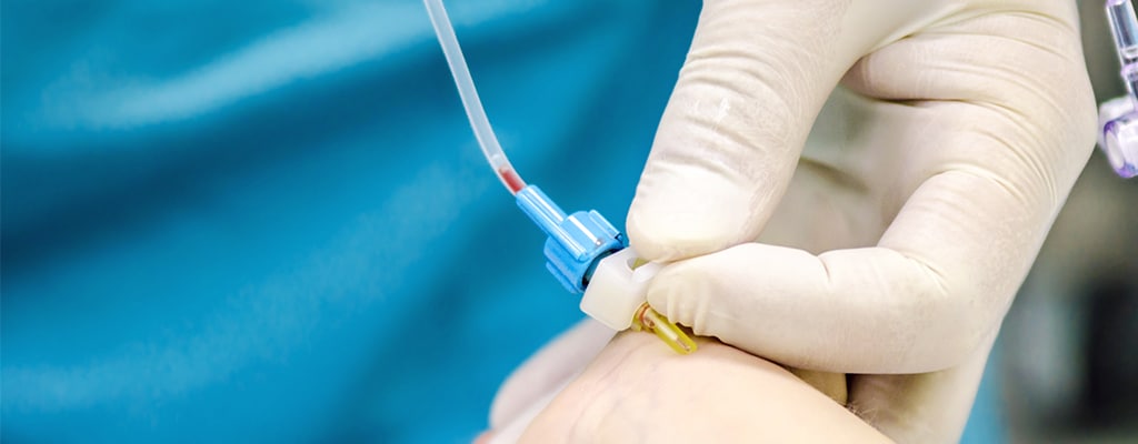 Sensoren für Druckkatheter