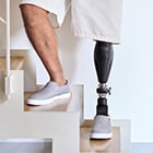 prosthetic leg on stair