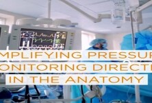 Intrasense Invasive Pressure Sensor Overview